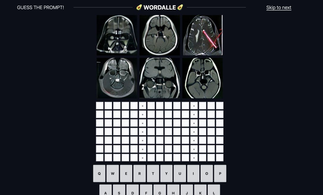 Can You Outsmart AI? ‘Wordalle’ Is ‘Wordle’ That Makes You Guess AI