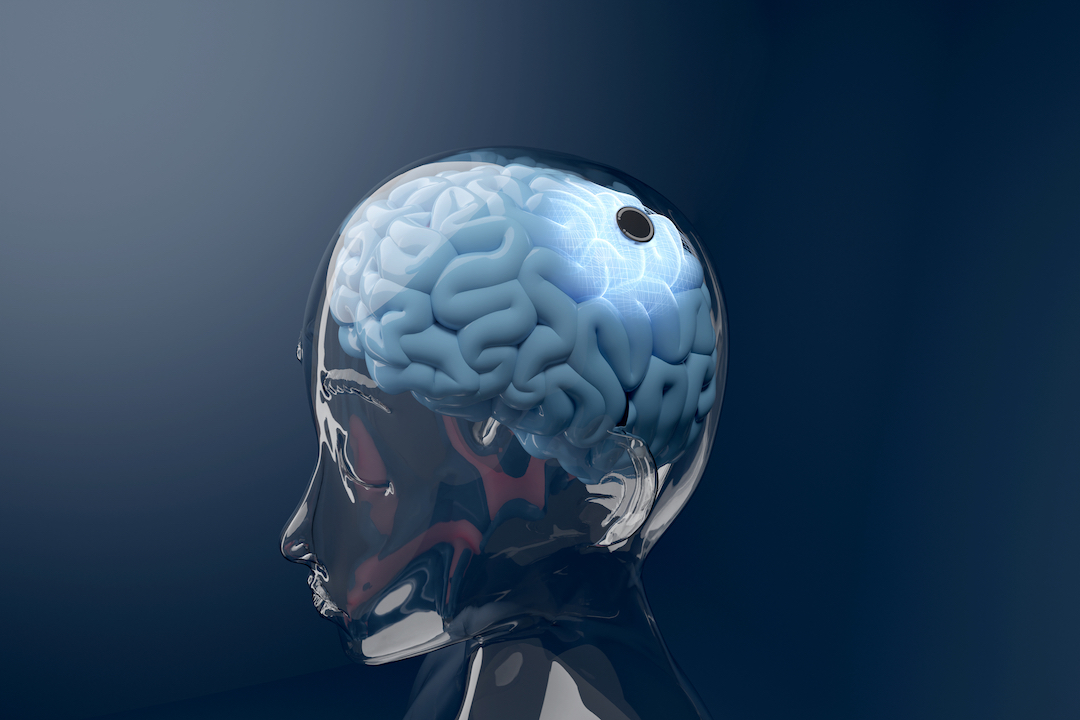 China-Brain-Computer-Interface-Neucyber-