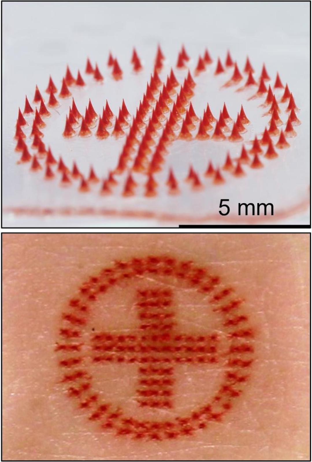 Researchers Develop Painless, Microneedle Tattoos You Can DIY At Home ...