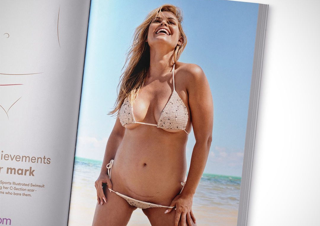 Sports Illustrated Spotlights First Swimsuit Model With Visible C-Section Scar