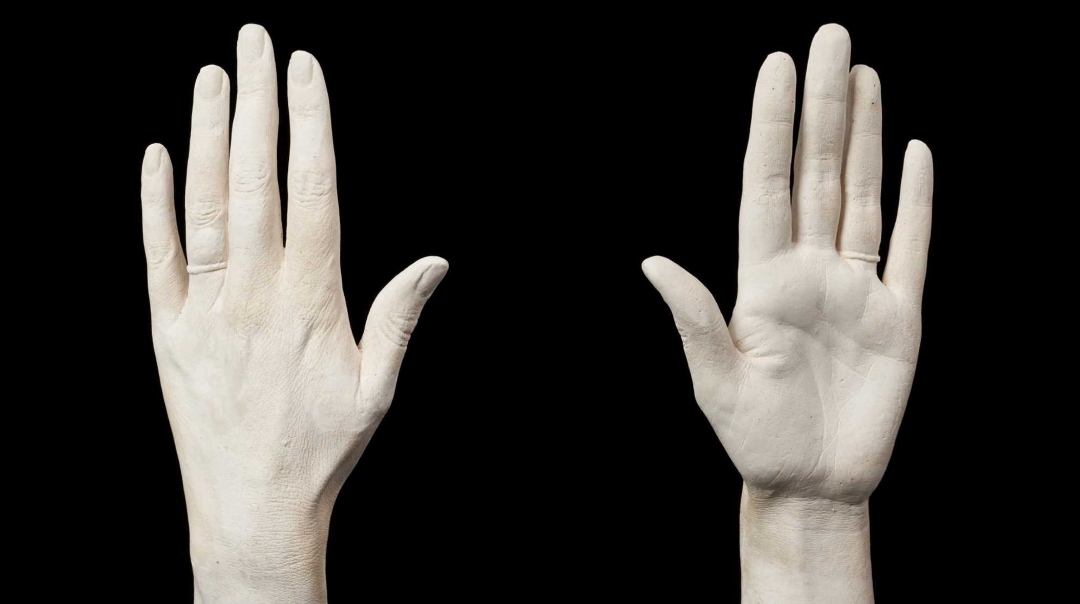 Princess Diana’s Gentle Touch Lives On As Hand Cast, Now Up For Auction